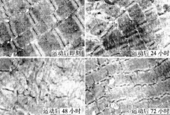 露营之家运动营养系列讲座之肌肉酸痛(图6) 露营之家运动营养系列讲座之肌肉酸痛(图6)