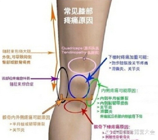 露营之家运动损伤与康复系列讲座(图4) 露营之家运动损伤与康复系列讲座(图4)